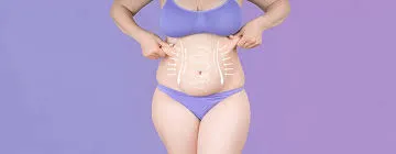 The Steps of a Tummy Tuck Procedure